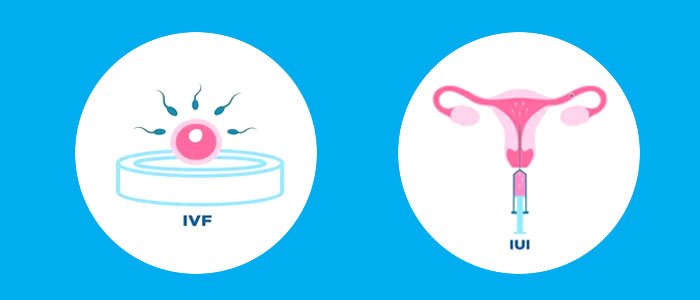 IUI and IVF