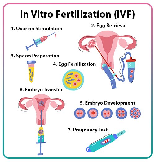 IVF